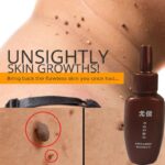 Skin Tag Remover Genital Wart Treatment Instant Removal Mole & papilloma’s Foot Corn Natural Bacteriostatic Repair Tool Liquid