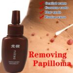 Skin Tag Remover Genital Wart Treatment Instant Removal Mole & papilloma’s Foot Corn Natural Bacteriostatic Repair Tool Liquid