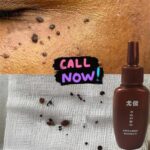 Skin Tag Remover Genital Wart Treatment Instant Removal Mole & papilloma’s Foot Corn Natural Bacteriostatic Repair Tool Liquid