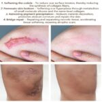 Scar Recovery Cream Fast Removal Skin Scars Treat of Surgery Scars Stretch Marks Acne Pox Prints Burn Repair Facial Care Gel