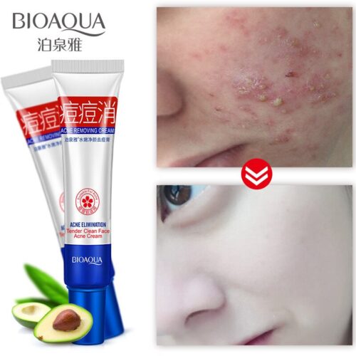 Acne Treatment Face Cream Acne Removal Anti Acne Scars