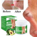 Foot Dead skin and Fungus Remover Moisturizer