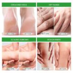 Foot Fungus Removal Cream Relieve Foot Itching Remove Beriberi Dead Skin Foot Sweat Moisturize Repair Foot Cracked Ointment