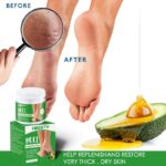 Foot Fungus Removal Cream Relieve Foot Itching Remove Beriberi Dead Skin Foot Sweat Moisturize Repair Foot Cracked Ointment