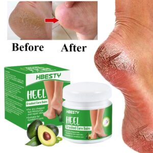 Foot Dead skin and Fungus Remover Moisturizer