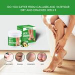 Foot Fungus Removal Cream Relieve Foot Itching Remove Beriberi Dead Skin Foot Sweat Moisturize Repair Foot Cracked Ointment