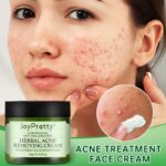 Acne Face Cream Herbal Pimple Scar Removal Shrink Pore Oil Control Moisturizing Facial Cream Acne Treatment Skin Care