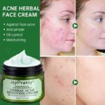 Acne Face Cream Herbal Pimple Scar Removal Shrink Pore Oil Control Moisturizing Facial Cream Acne Treatment Skin Care