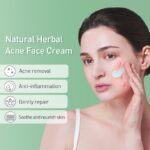 Acne Face Cream Herbal Pimple Scar Removal Shrink Pore Oil Control Moisturizing Facial Cream Acne Treatment Skin Care