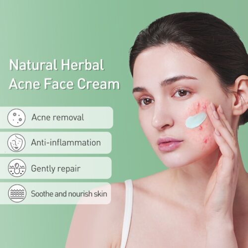 Herbal Acne Removal Cream