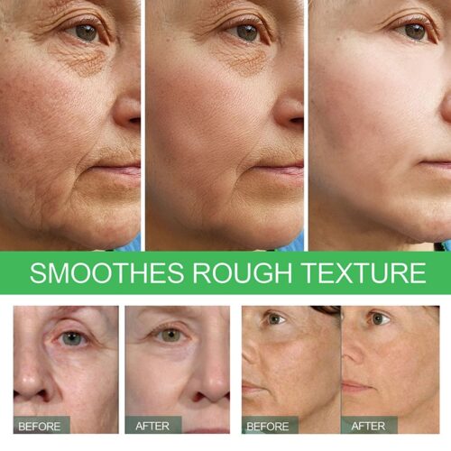 Wrinkle Remover Face Serum - Unlocking smoother, younger-looking skin.