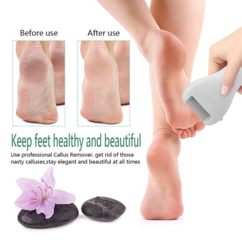 A specialized pedicure tool for effective and easy foot care.