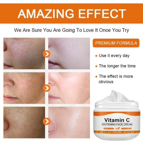Dark Spots Remover Vitamin C cream